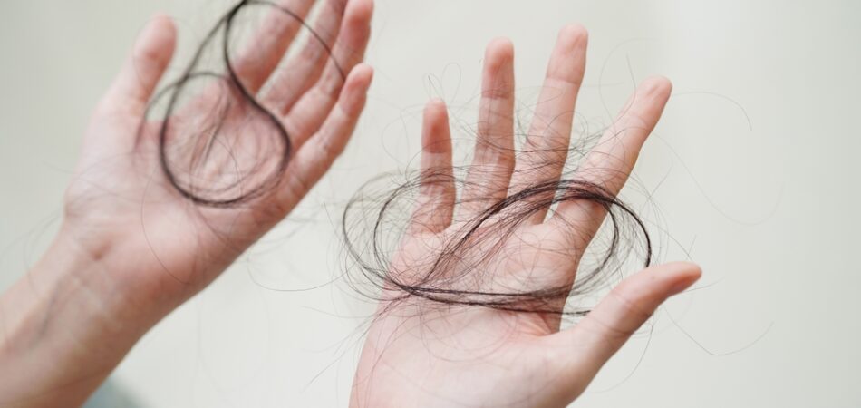 Hair Loss And Balding