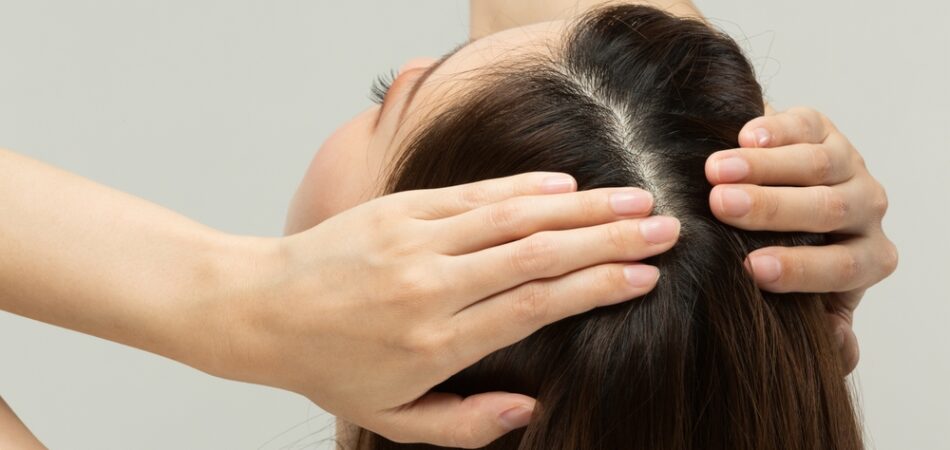 Close Up,of,a,young,woman's,scalp,.