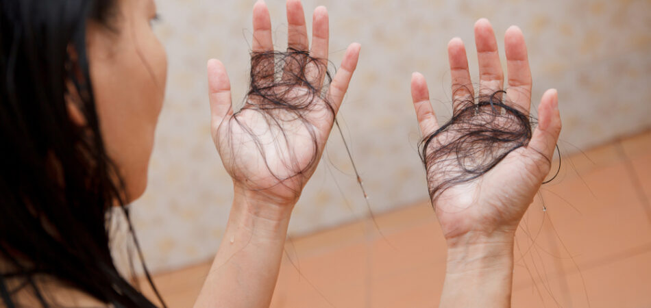 Hair,falling,out,in,two,hands,after,rinse,off,shampoo.